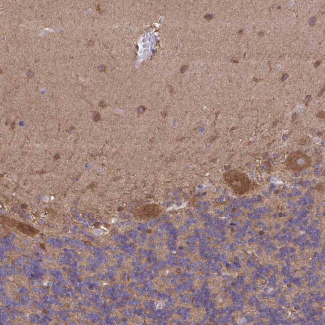 PIGZ Antibody in Immunohistochemistry (Paraffin) (IHC (P))