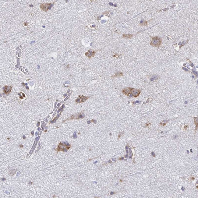 TMEM241 Antibody in Immunohistochemistry (Paraffin) (IHC (P))