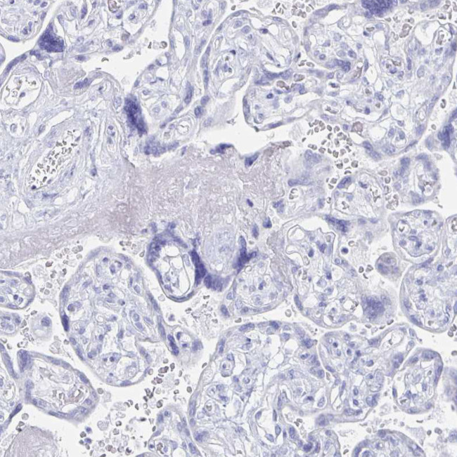 PRDM7 Antibody in Immunohistochemistry (Paraffin) (IHC (P))