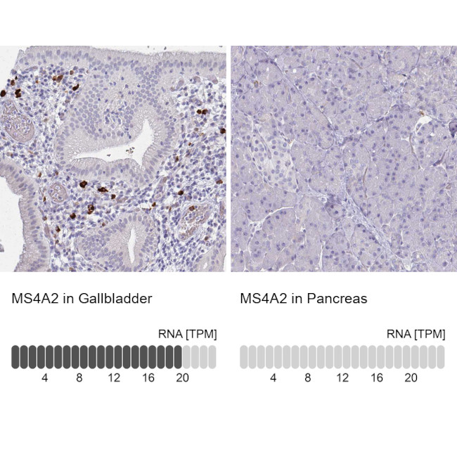 MS4A2 Antibody in Immunohistochemistry (IHC)