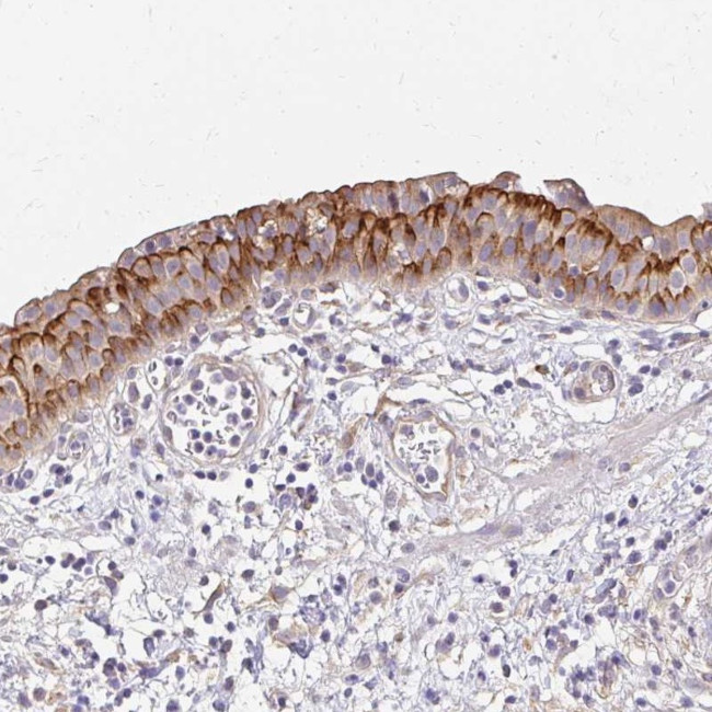 PRIMA1 Antibody in Immunohistochemistry (Paraffin) (IHC (P))
