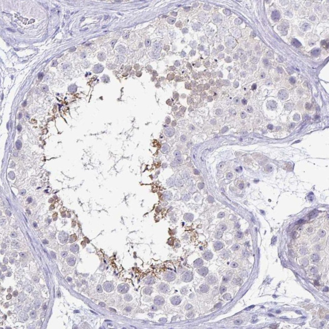 IRGC Antibody in Immunohistochemistry (Paraffin) (IHC (P))