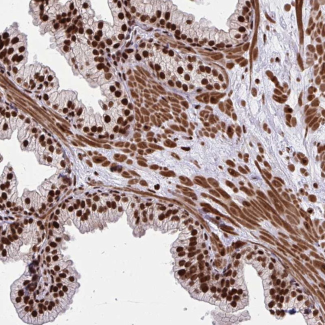 TBL1Y Antibody in Immunohistochemistry (Paraffin) (IHC (P))