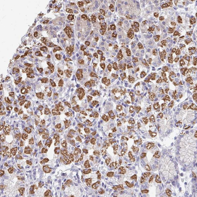 OR10V1 Antibody in Immunohistochemistry (Paraffin) (IHC (P))