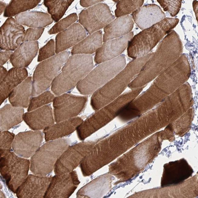 CLIC2 Antibody in Immunohistochemistry (Paraffin) (IHC (P))