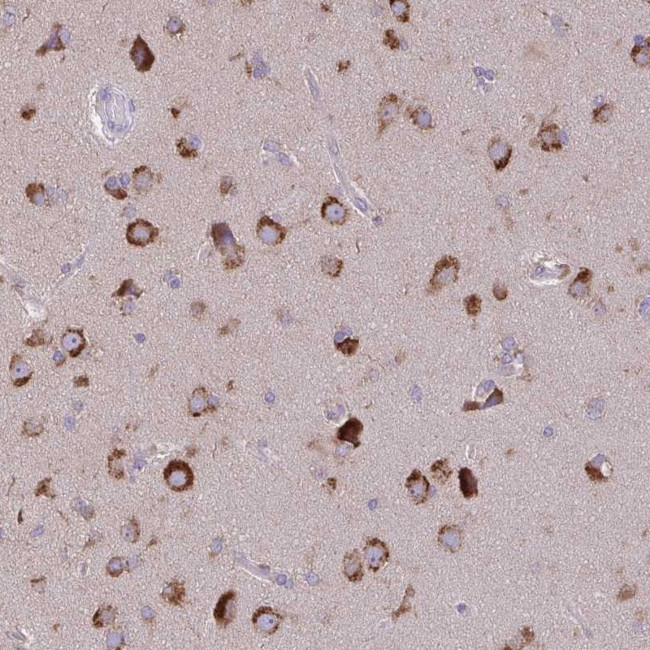 VTI1B Antibody in Immunohistochemistry (Paraffin) (IHC (P))