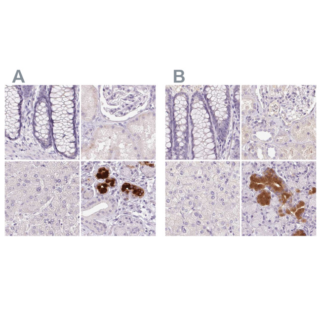 BPIL1 Antibody in Immunohistochemistry (IHC)