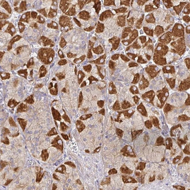 SNX8 Antibody in Immunohistochemistry (IHC)