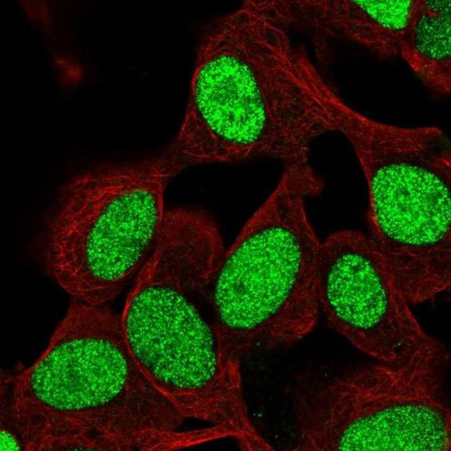 ZNF554 Antibody in Immunocytochemistry (ICC/IF)