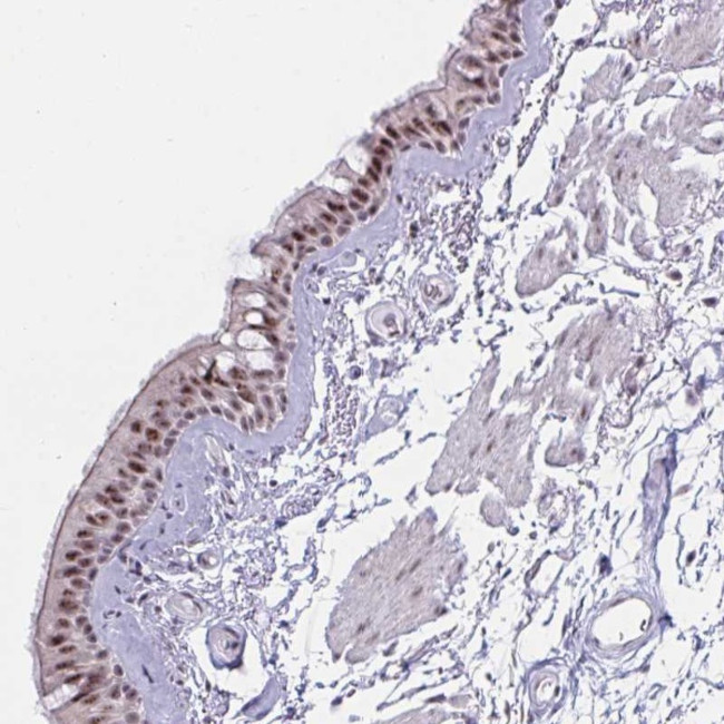 PRR14 Antibody in Immunohistochemistry (Paraffin) (IHC (P))