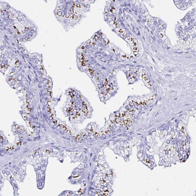 ZNF432 Antibody in Immunohistochemistry (Paraffin) (IHC (P))