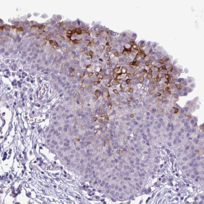 PRSS45 Antibody in Immunohistochemistry (Paraffin) (IHC (P))
