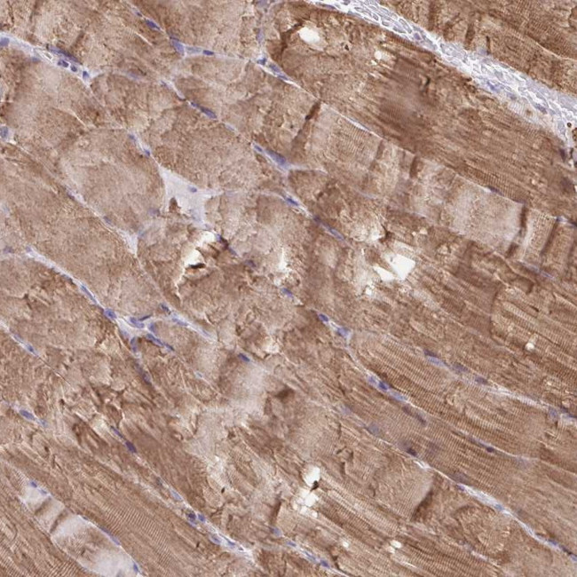 KLHL34 Antibody in Immunohistochemistry (Paraffin) (IHC (P))