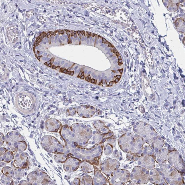 GLYATL2 Antibody in Immunohistochemistry (Paraffin) (IHC (P))