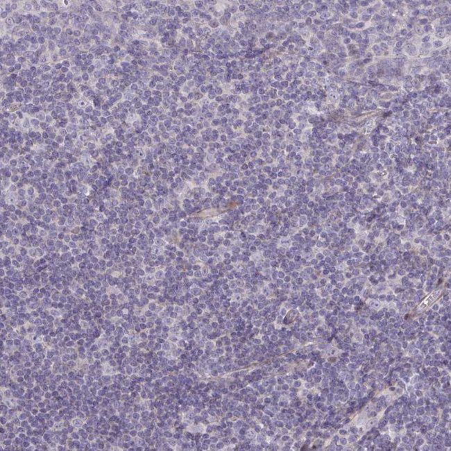 C8orf22 Antibody in Immunohistochemistry (Paraffin) (IHC (P))