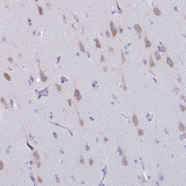 BRUNOL5 Antibody in Immunohistochemistry (Paraffin) (IHC (P))