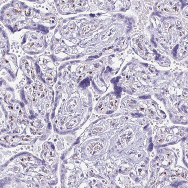 FAM162B Antibody in Immunohistochemistry (Paraffin) (IHC (P))