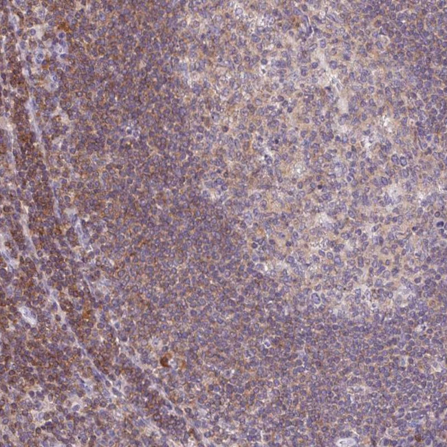 KIF26A Antibody in Immunohistochemistry (Paraffin) (IHC (P))