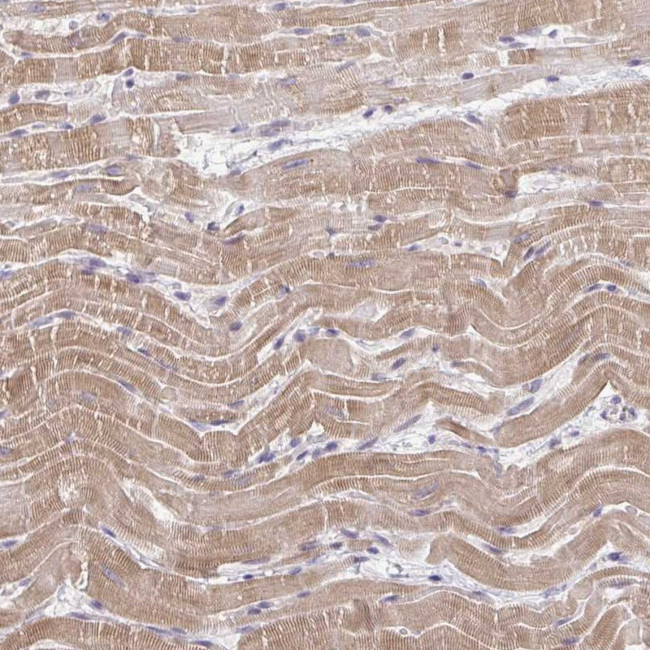 FAM195A Antibody in Immunohistochemistry (Paraffin) (IHC (P))