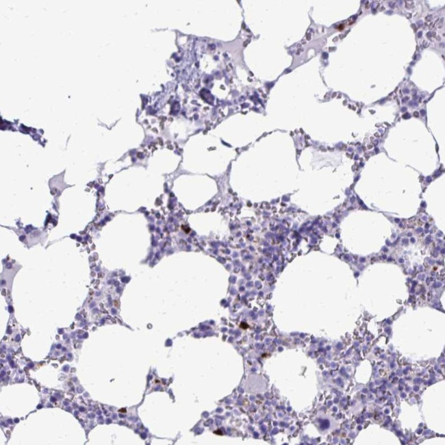 SATL1 Antibody in Immunohistochemistry (Paraffin) (IHC (P))