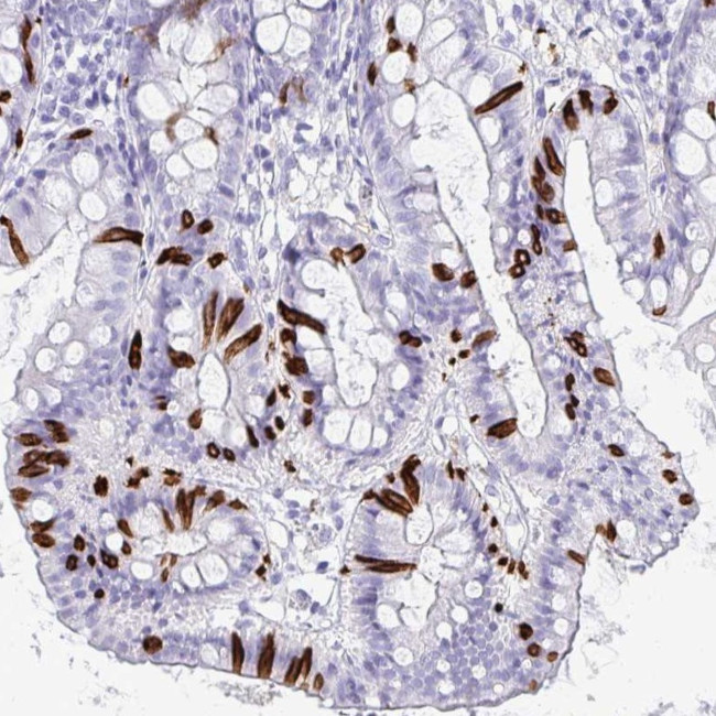 NANOGNB Antibody in Immunohistochemistry (Paraffin) (IHC (P))