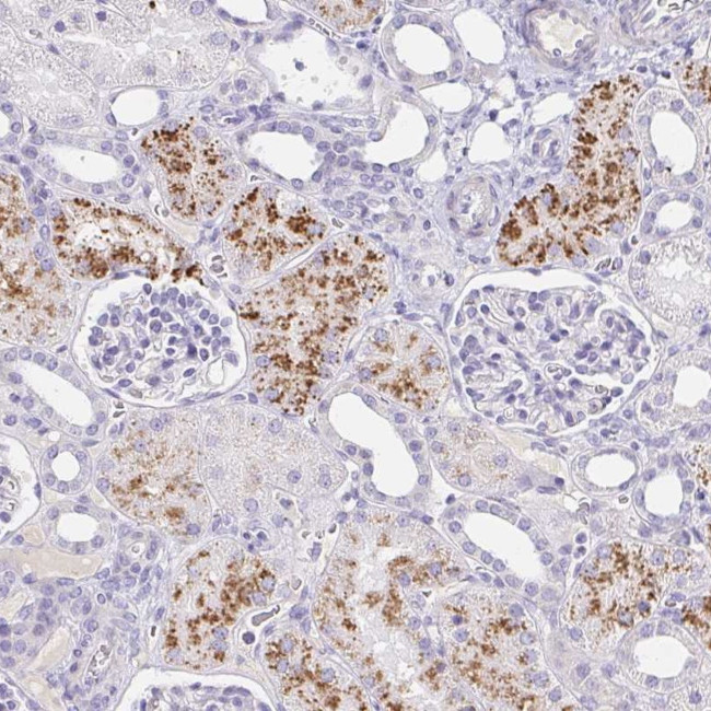 C4orf17 Antibody in Immunohistochemistry (Paraffin) (IHC (P))
