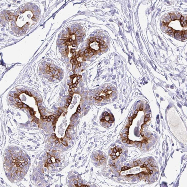 TAF1D Antibody in Immunohistochemistry (Paraffin) (IHC (P))