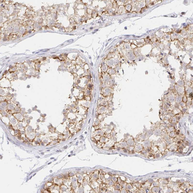 COL28A1 Antibody in Immunohistochemistry (Paraffin) (IHC (P))