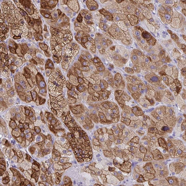 ZFP82 Antibody in Immunohistochemistry (Paraffin) (IHC (P))