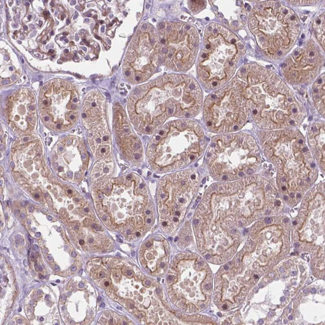 ARHE Antibody in Immunohistochemistry (Paraffin) (IHC (P))