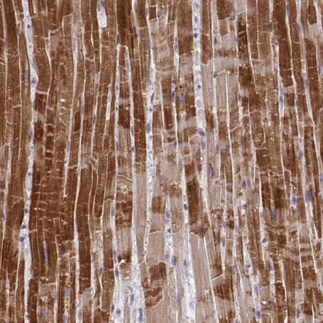 MP68 Antibody in Immunohistochemistry (IHC)