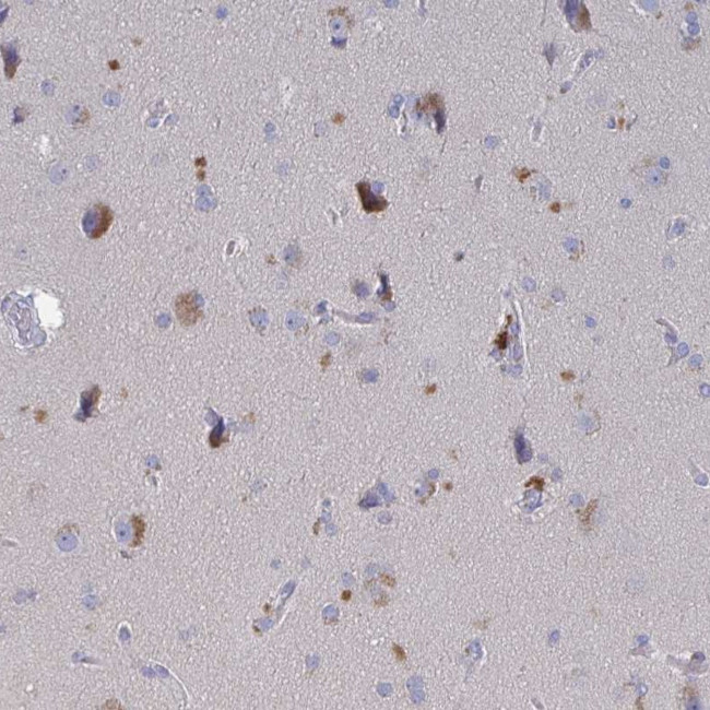 GPR148 Antibody in Immunohistochemistry (Paraffin) (IHC (P))