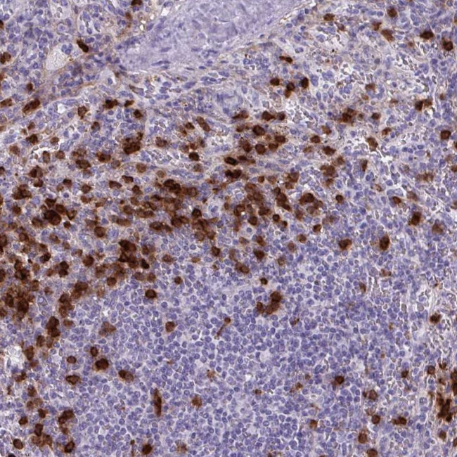 TMEM133 Antibody in Immunohistochemistry (Paraffin) (IHC (P))