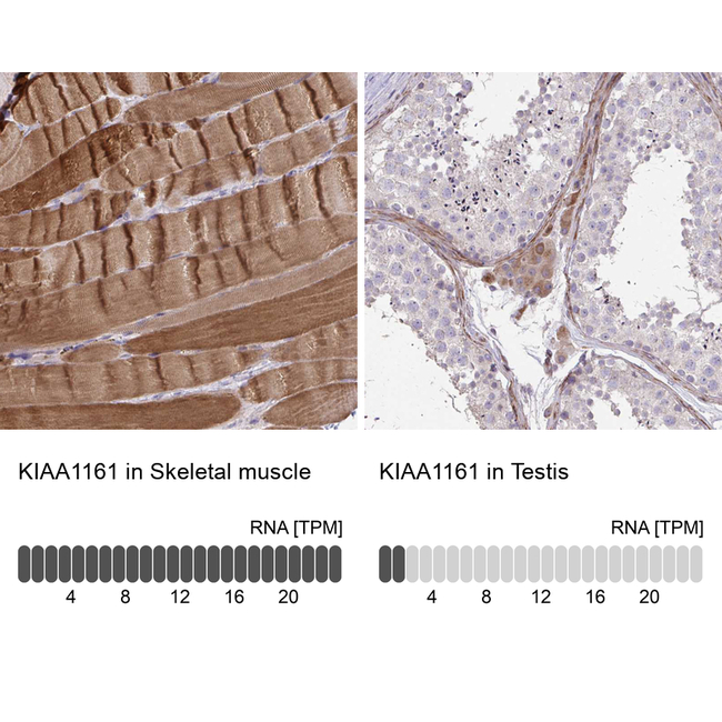 KIAA1161 Antibody in Immunohistochemistry (Paraffin) (IHC (P))