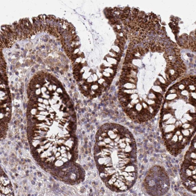 CP054 Antibody in Immunohistochemistry (Paraffin) (IHC (P))