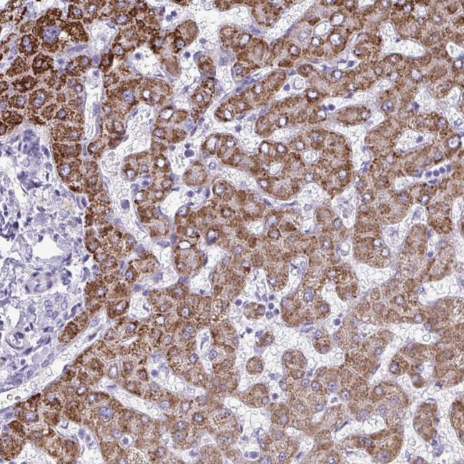 ANKRD60 Antibody in Immunohistochemistry (Paraffin) (IHC (P))