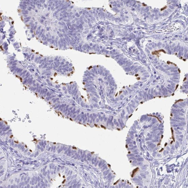 C4orf17 Antibody in Immunohistochemistry (Paraffin) (IHC (P))