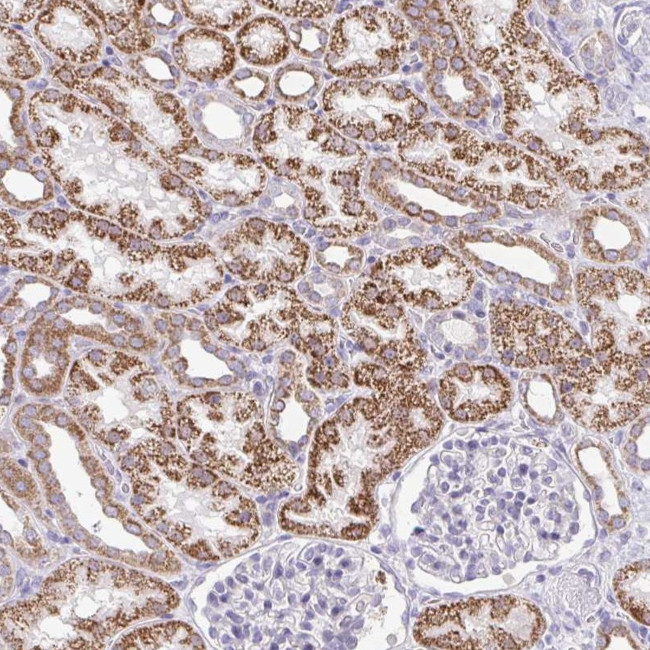 PRRG3 Antibody in Immunohistochemistry (Paraffin) (IHC (P))