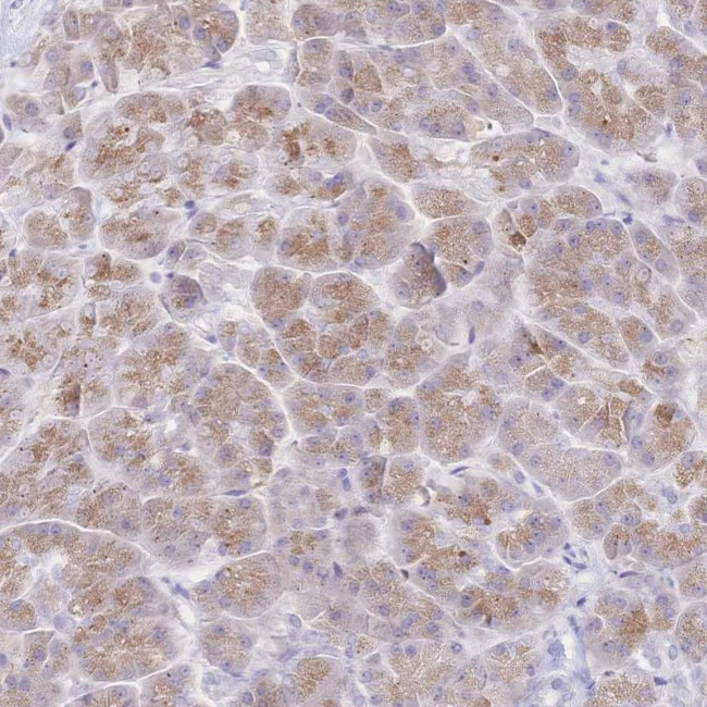 SIAH3 Antibody in Immunohistochemistry (Paraffin) (IHC (P))