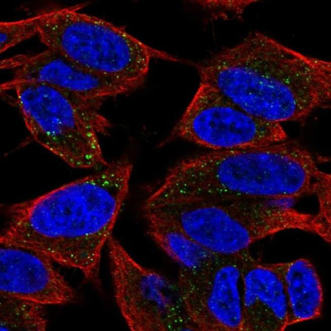 TVP23A Antibody in Immunocytochemistry (ICC/IF)