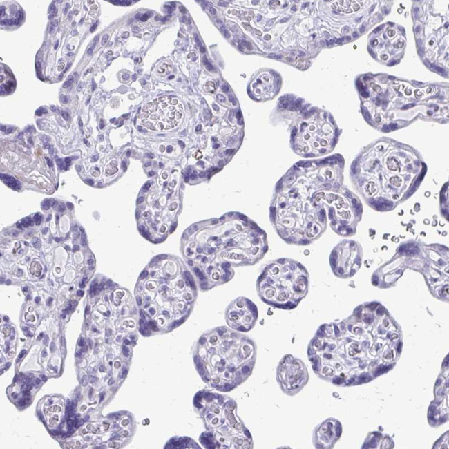 LCN15 Antibody in Immunohistochemistry (Paraffin) (IHC (P))