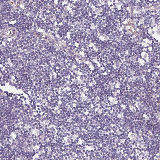 LPA Antibody in Immunohistochemistry (Paraffin) (IHC (P))