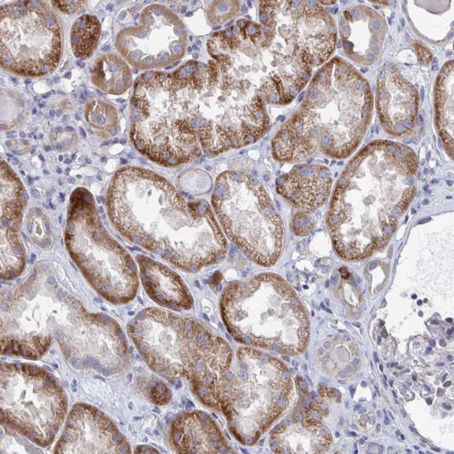 PLEKHG7 Antibody in Immunohistochemistry (Paraffin) (IHC (P))