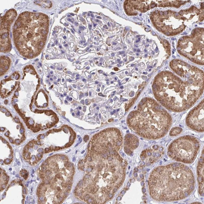 WBSCR16 Antibody in Immunohistochemistry (Paraffin) (IHC (P))
