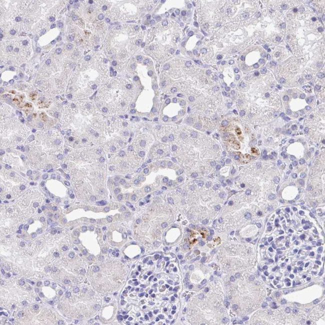 TAS2R39 Antibody in Immunohistochemistry (Paraffin) (IHC (P))