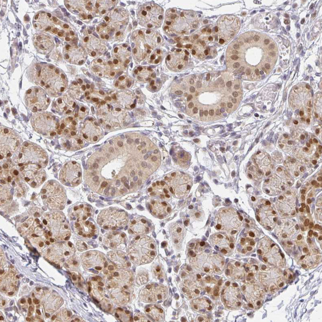 EHF Antibody in Immunohistochemistry (Paraffin) (IHC (P))