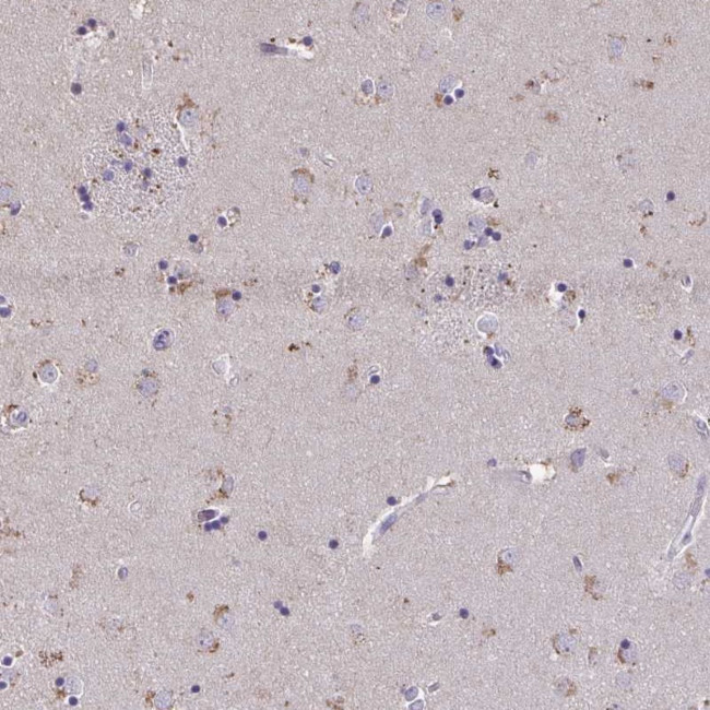 ZNF34 Antibody in Immunohistochemistry (Paraffin) (IHC (P))