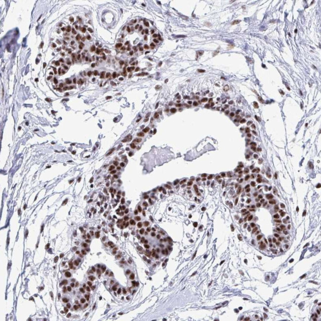 MNAR Antibody in Immunohistochemistry (Paraffin) (IHC (P))