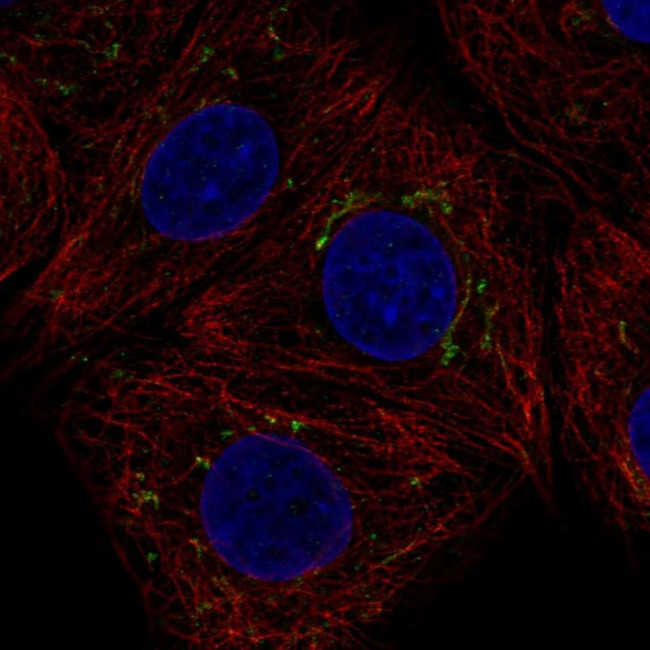 AIG1 Antibody in Immunocytochemistry (ICC/IF)