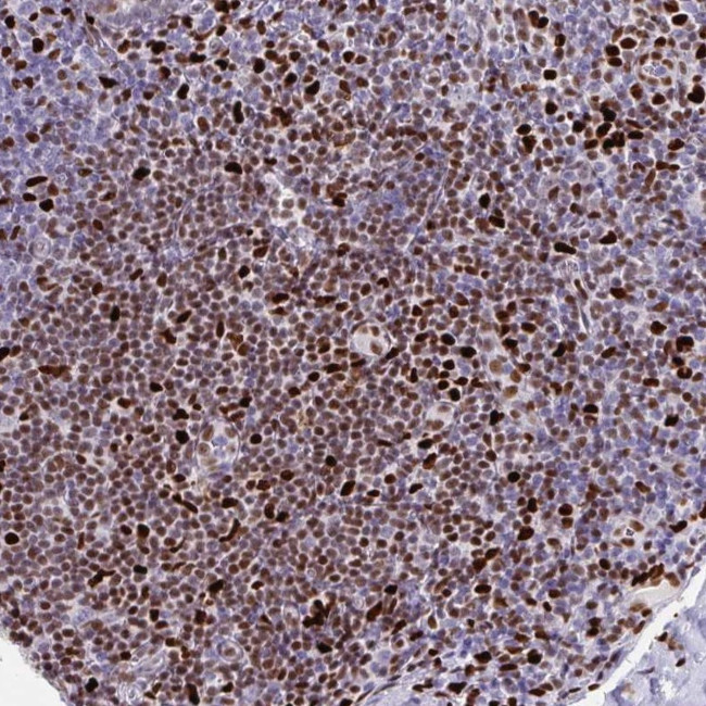 ZNF586 Antibody in Immunohistochemistry (Paraffin) (IHC (P))